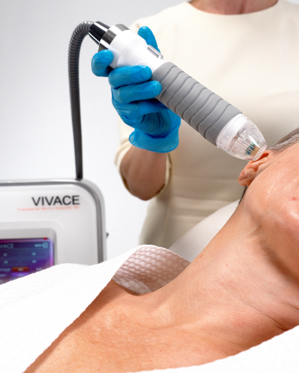 Vivace Microneedling behandeling bij Huid- en Oedeemtherapie Oss